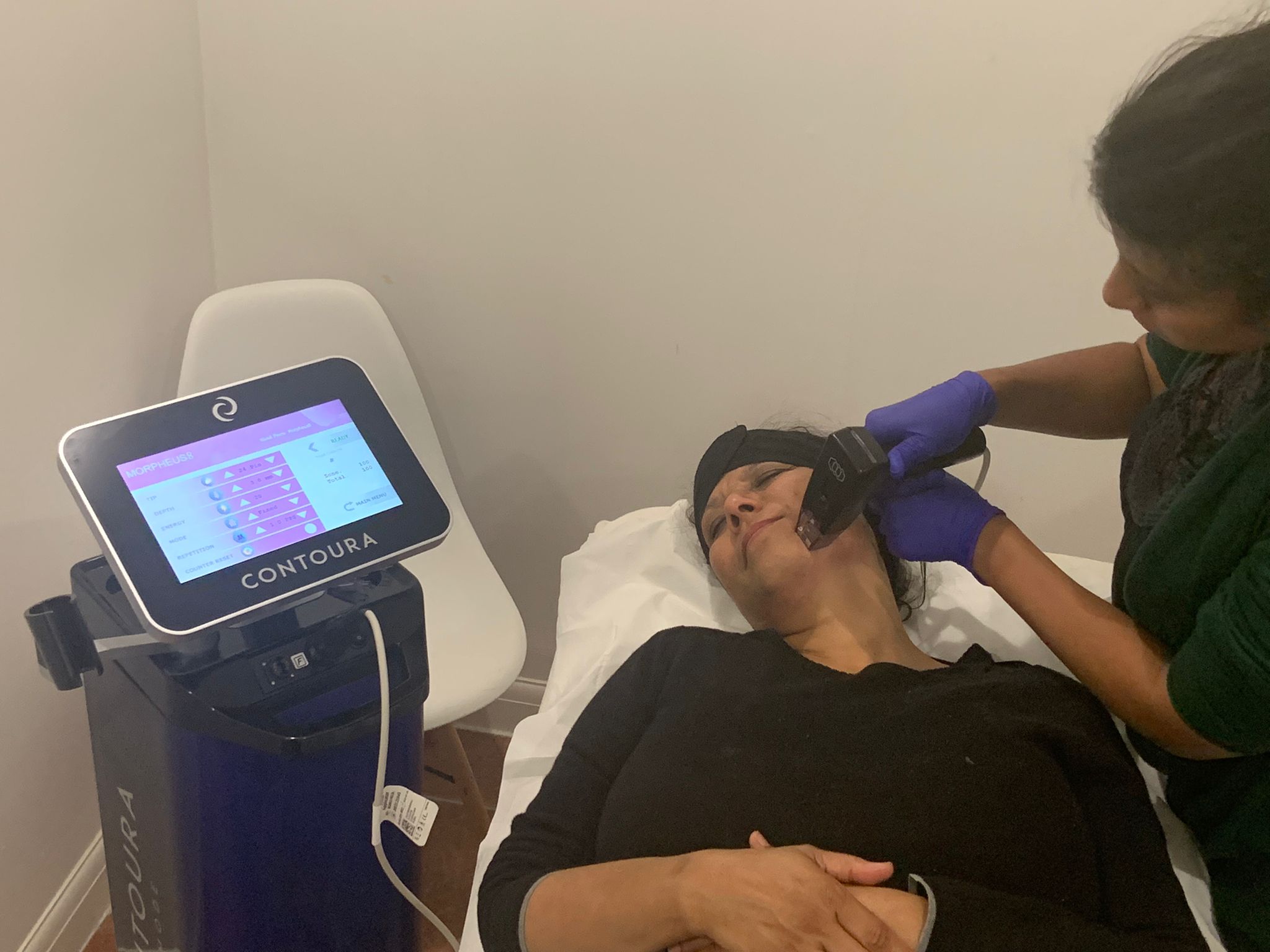 Morepheus8 treatment in Caterham, Surrey